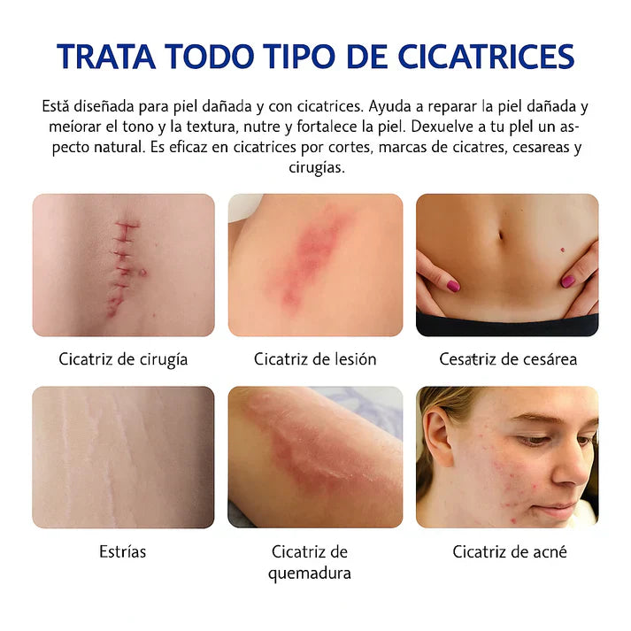 CREMA ELIMINA CICATRICES